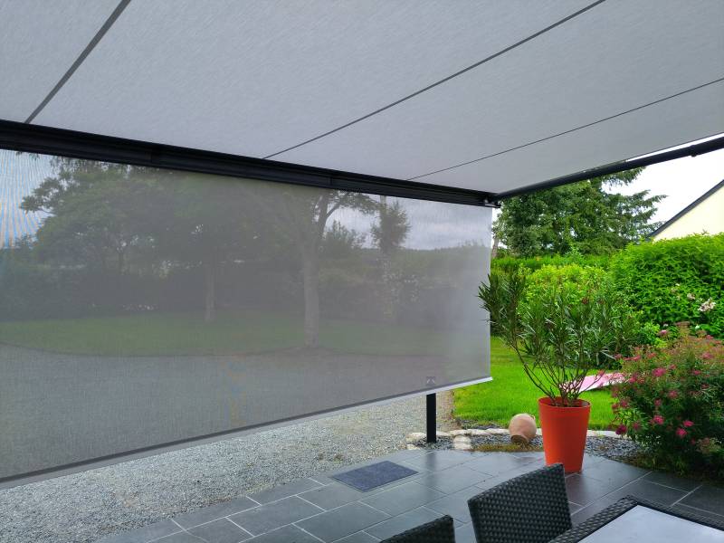 Installateur store solaire sur LYON - votre expert sur mesure CLINIQUE DU STORE